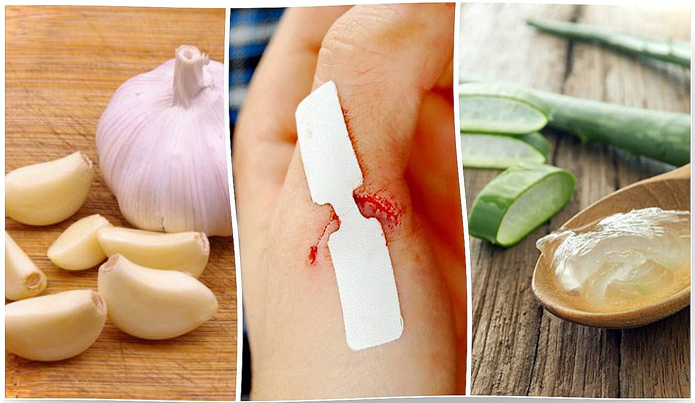 10 natural antiseptics to treat superficial wounds