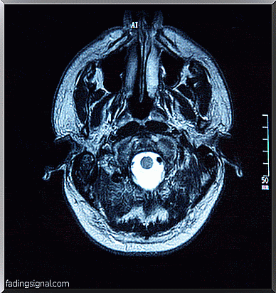 Gif of a brain