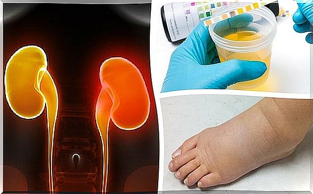 8 symptoms of kidney failure most people ignore