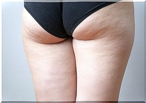 Fight cellulite