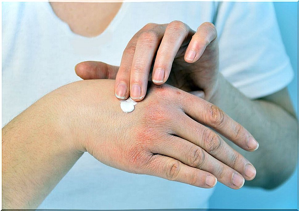 Woman putting cream on her hands