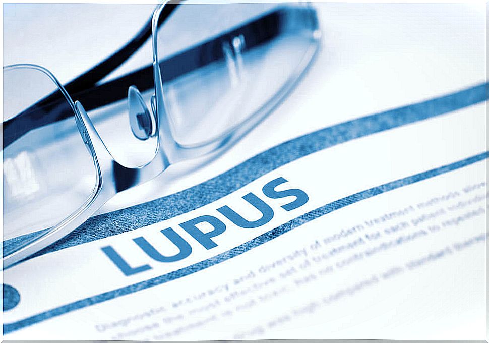 Lupus