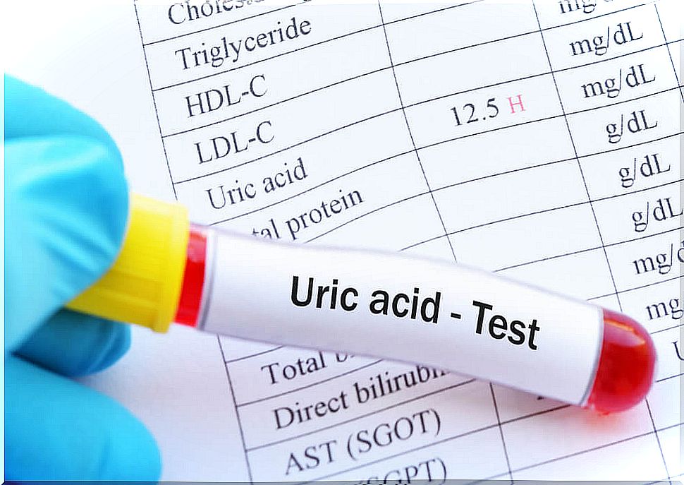 High uric acid: what are the consequences?