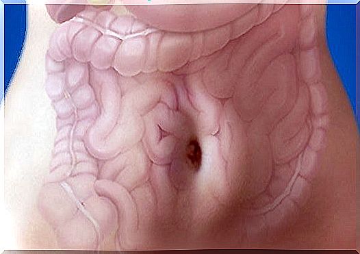 inflammatory bowel disease (IBD) 