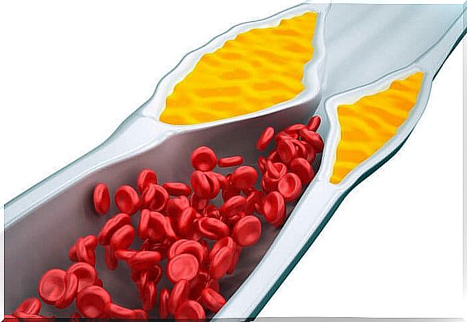 Recreation of blood vessel with fat and red blood cells.